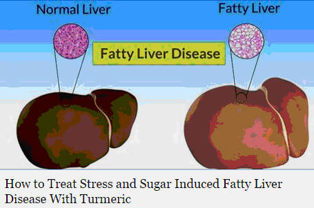 Fatty Liver Turmeric